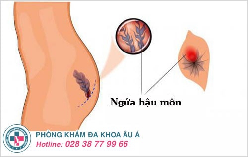 apxe hậu môn