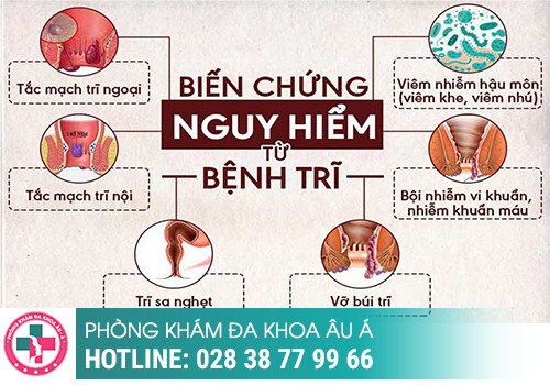 nguyên nhân trĩ tắc mạch