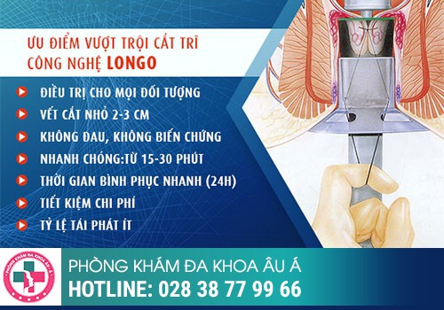 Cắt búi trĩ bằng phương pháp Longo