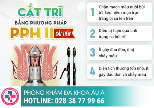 Phương pháp phẫu thuật trĩ bằng PPH