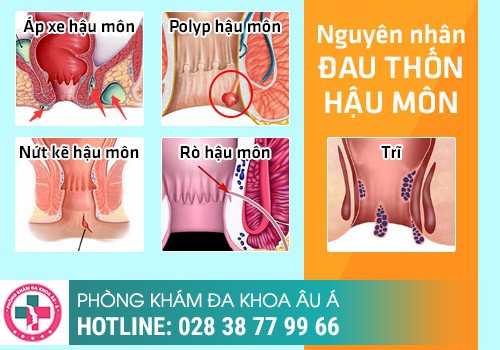 Nguyên nhân gây bệnh hậu môn