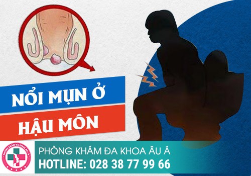 Nổi mụn xung quanh hậu môn cảnh báo bệnh gì?