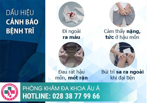 Đâu là những dấu hiệu bệnh trĩ tái phát cần lưu ý?