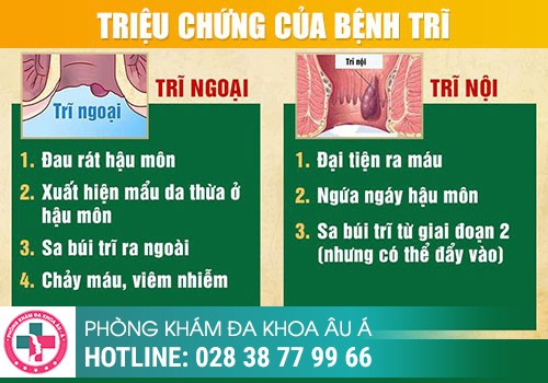 Nguyên nhân gây ngứa hậu môn