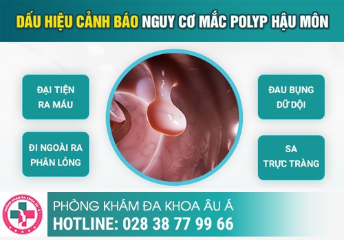 Da thừa ở hậu môn là dấu hiệu của bệnh gì?