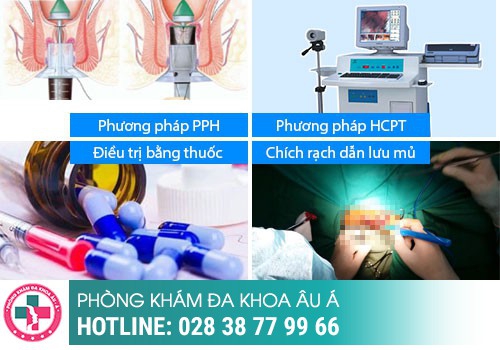 điều trị bệnh trĩ không đau