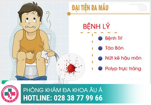 Đi cầu đau bất thường là bệnh gì?