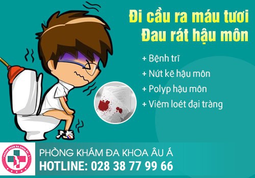 Nguyên nhân đi cầu bị bón chảy máu hậu môn là gì?