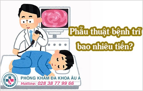 phẫu thuật bệnh trĩ bao nhiêu tiền