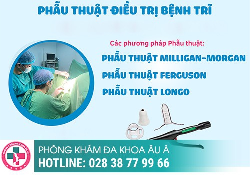 Đâu mới là phương pháp tối ưu giúp điều trị bệnh trĩ hiệu quả?