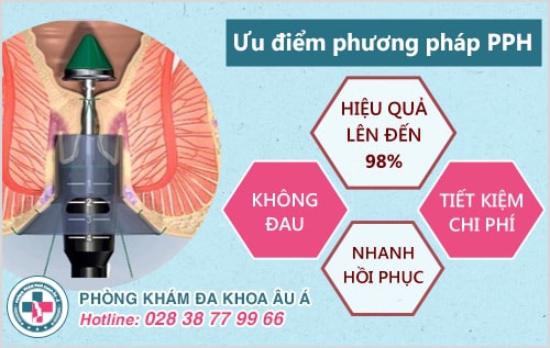 Phương pháp phẫu thuật trĩ hiệu quả nhất hiện nay?