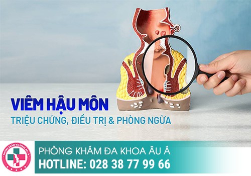 Viêm hậu môn là bệnh gì