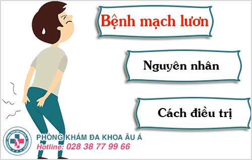 bệnh mạch lươn bệnh mạch lươn
